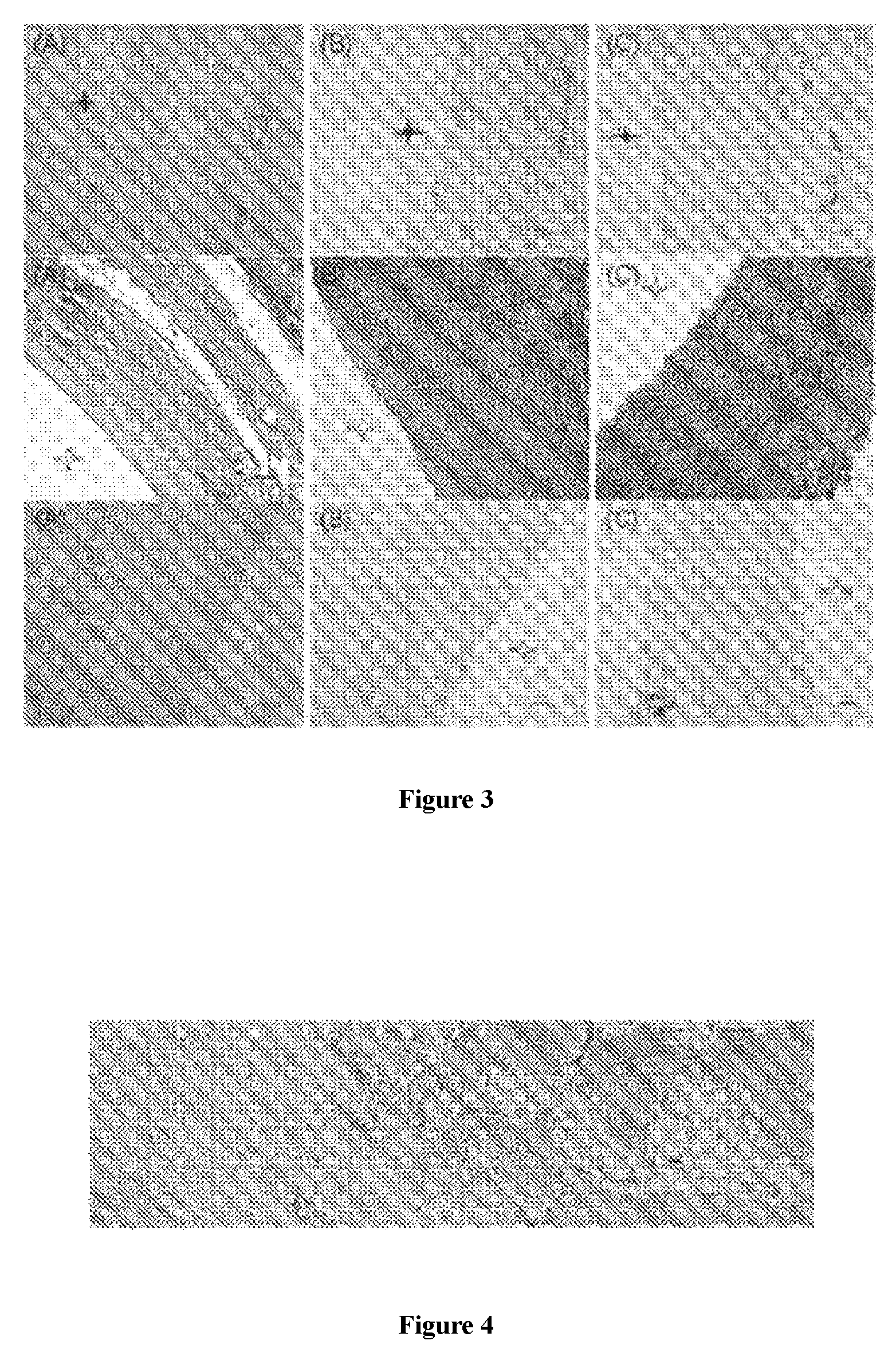 Hydrophilic electrospinning biological composite stent material used for tissue regeneration and preparation method and application thereof