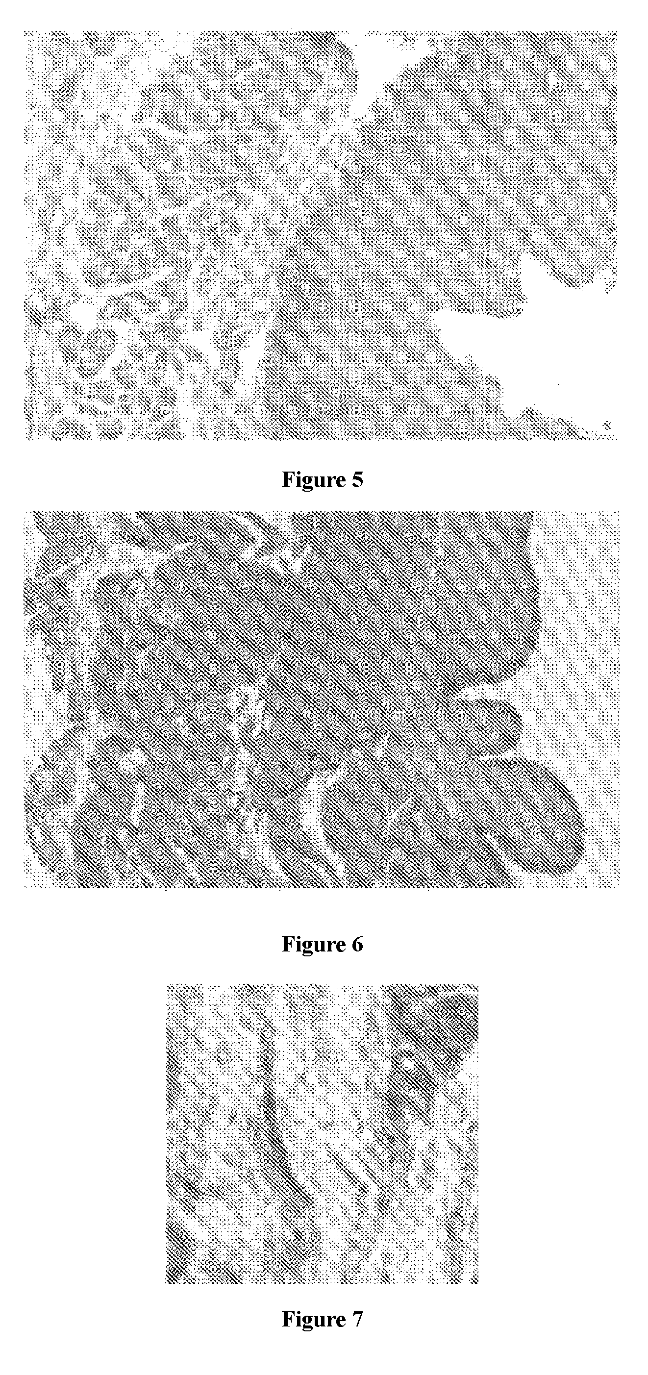 Hydrophilic electrospinning biological composite stent material used for tissue regeneration and preparation method and application thereof