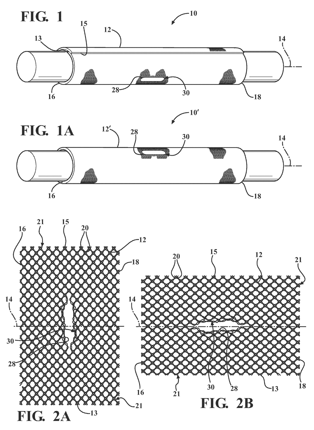 Braided textile sleeve with integrated opening and self-sustaining expanded and contracted states and method of construction thereof