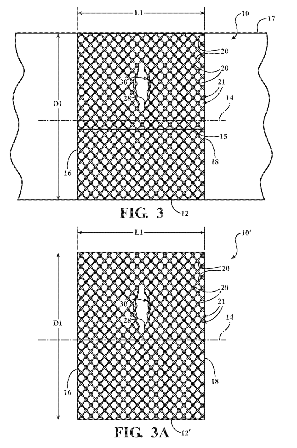 Braided textile sleeve with integrated opening and self-sustaining expanded and contracted states and method of construction thereof