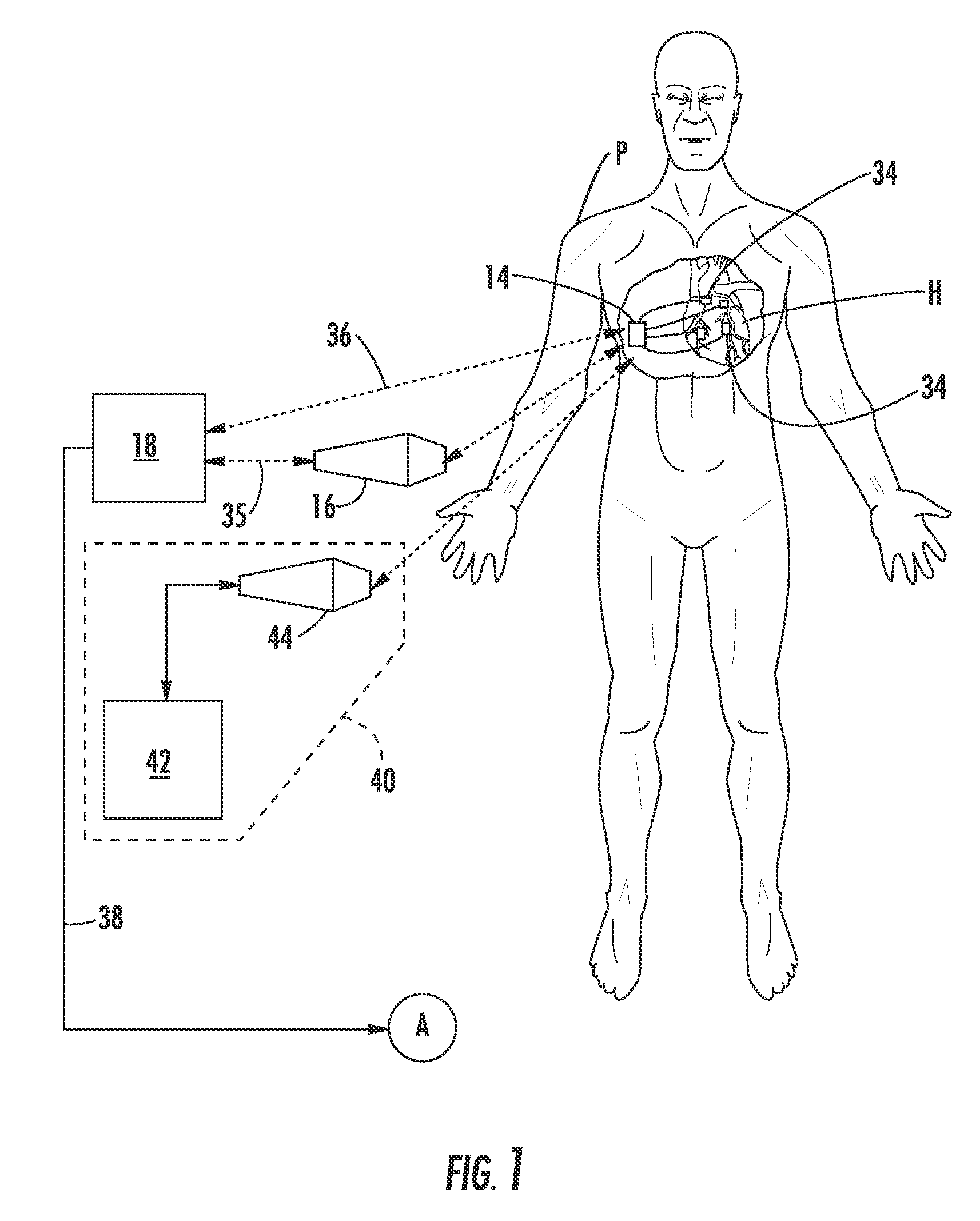 System and method for heart monitoring