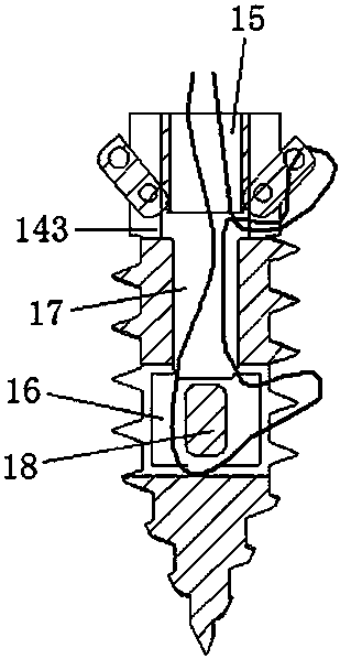 A threaded anchor