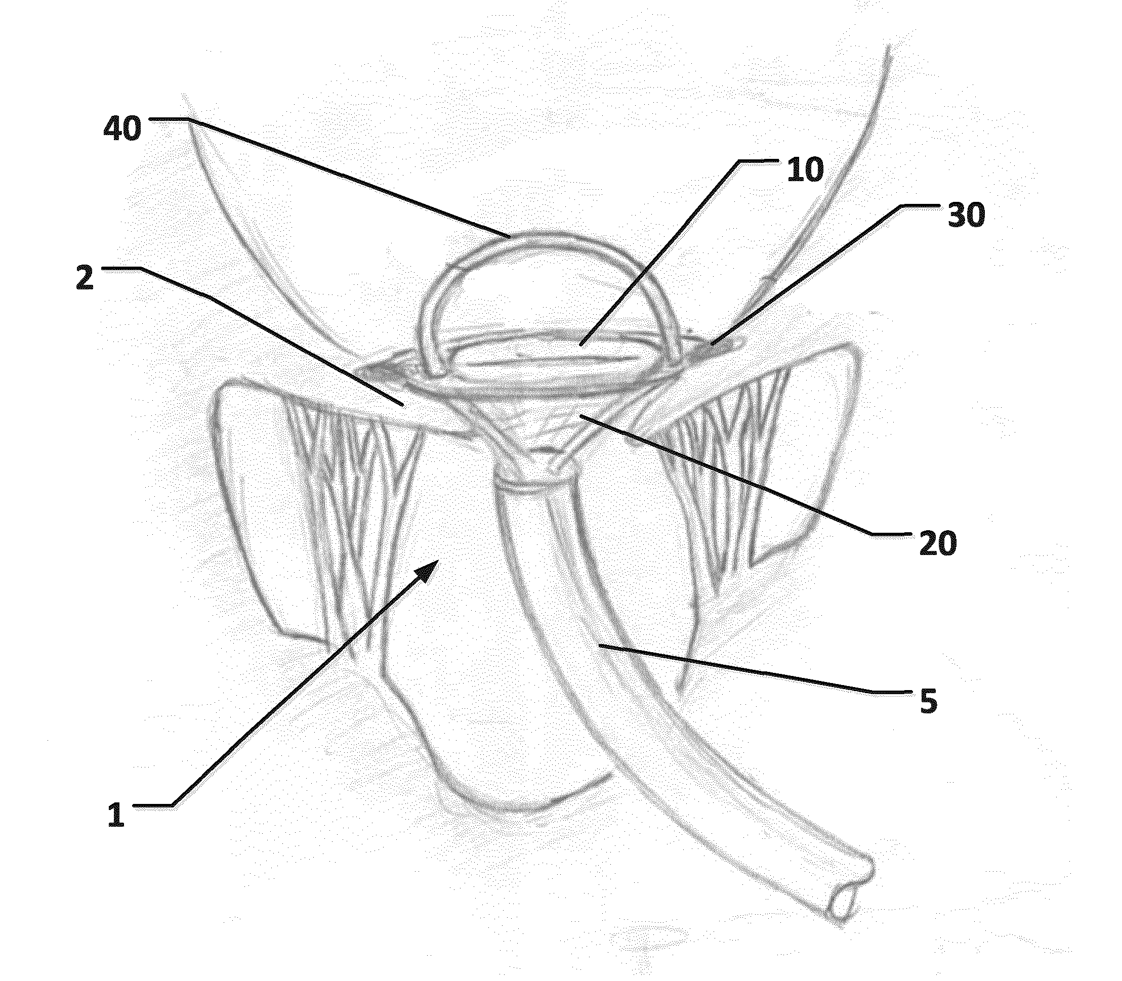 A System For Cardiac Valve Repair