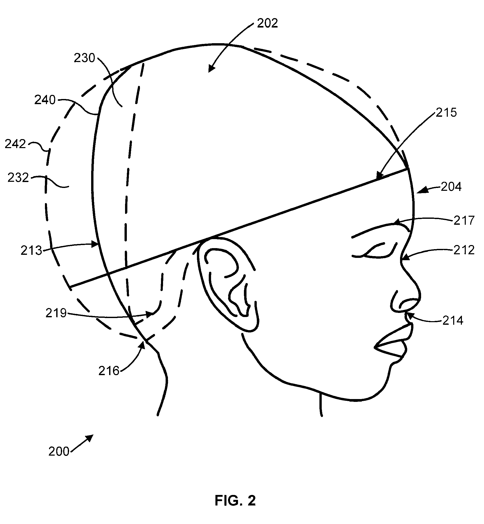 In situ molded orthotic and method for its fabrication