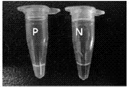 Primer group for detecting clonorchis sinensis and detection method thereof