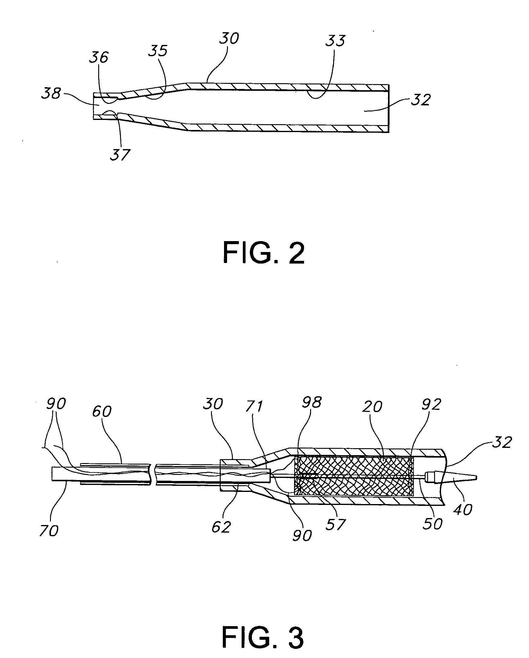 Apparatus and method for loading and delivering a stent