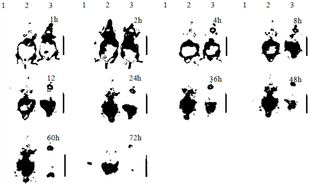 Nano-particle wrapped with small RNA (Ribose Nucleic Acid) for inhibiting embryo implantation