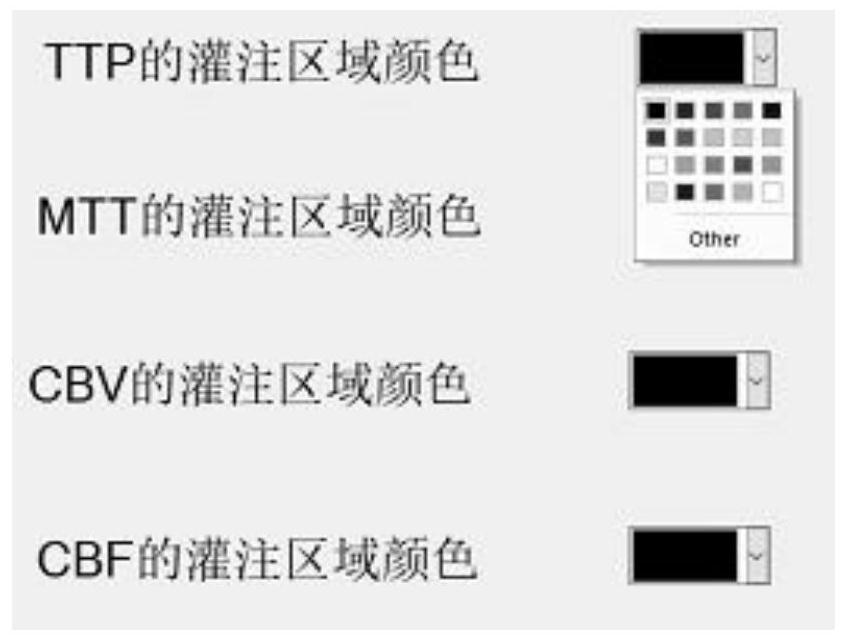 Perfusion image judgment system and method based on opencv, intelligent terminal