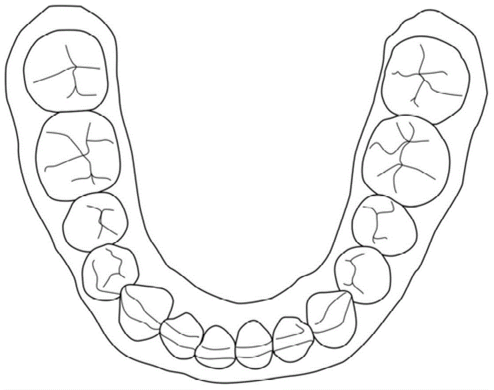 Method and system for producing dental brace