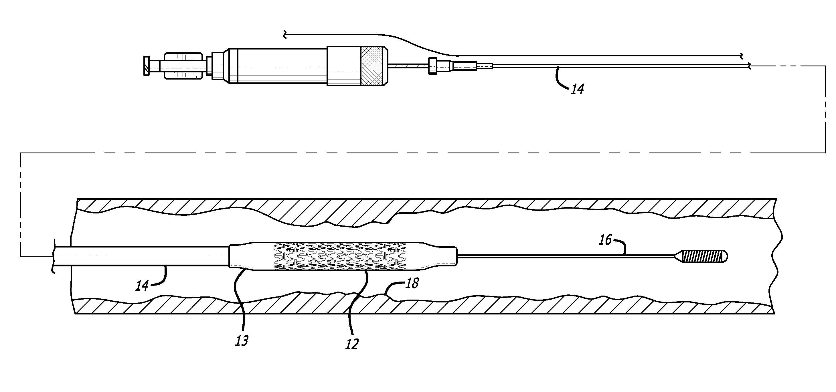 Method for measuring stent dislodgement force