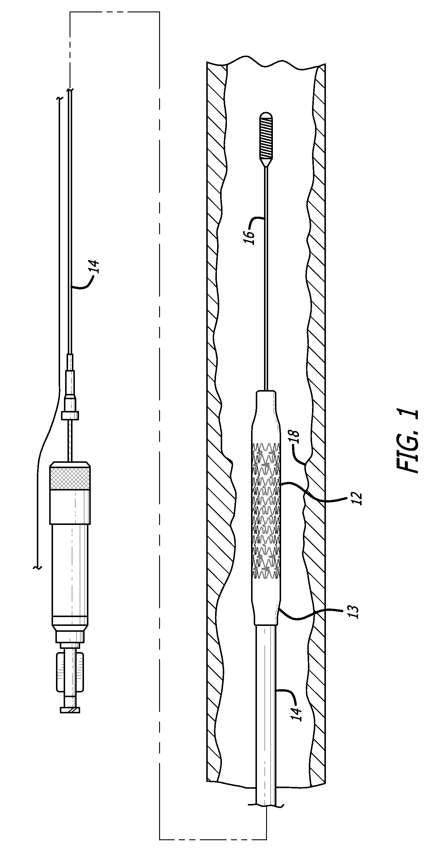 Method for measuring stent dislodgement force