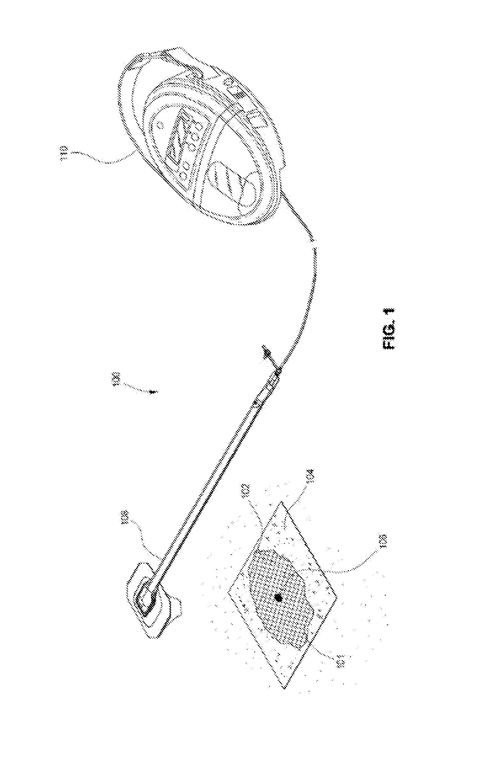 Negative pressure wound closure device