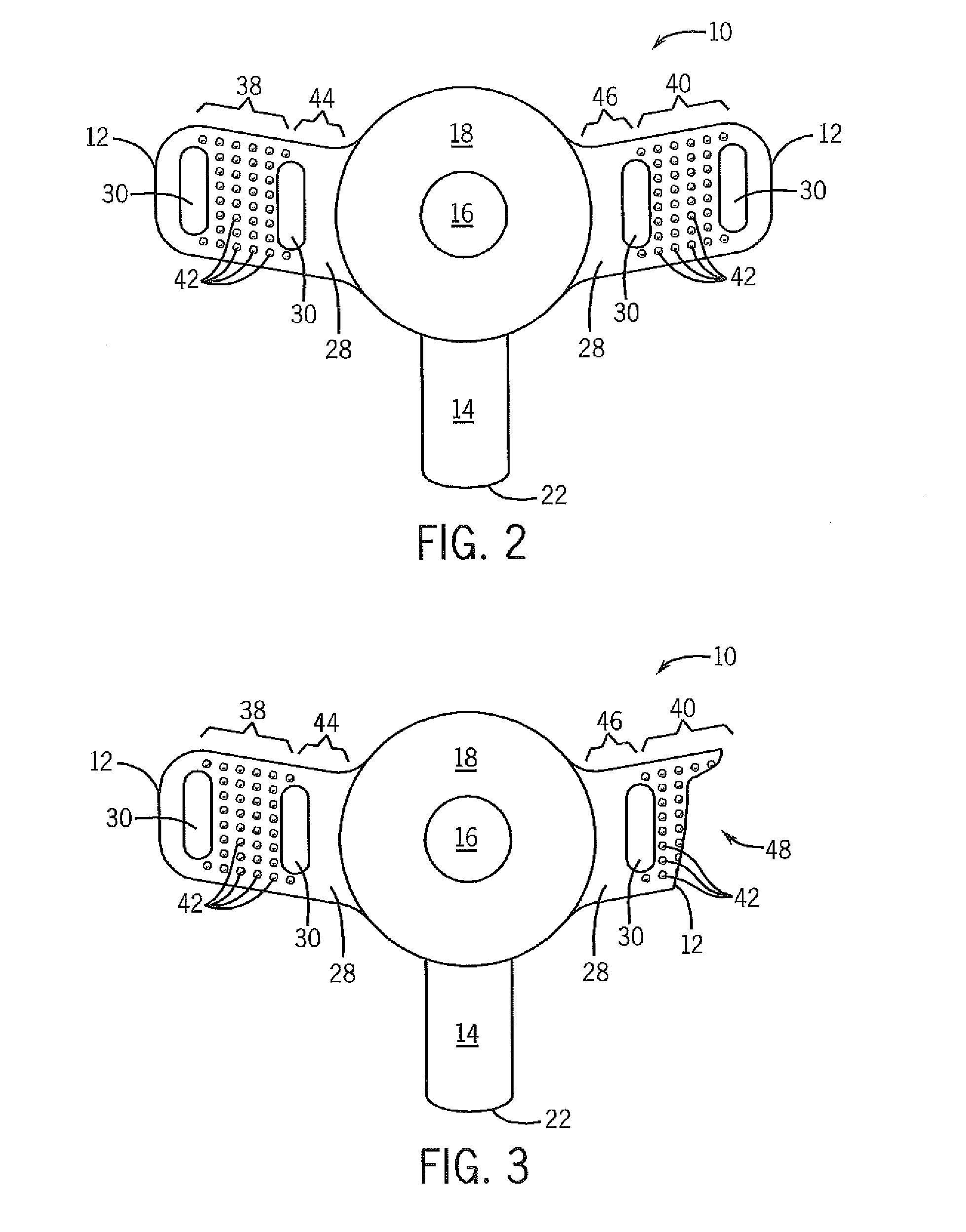 Tracheal tube with customizable flanges