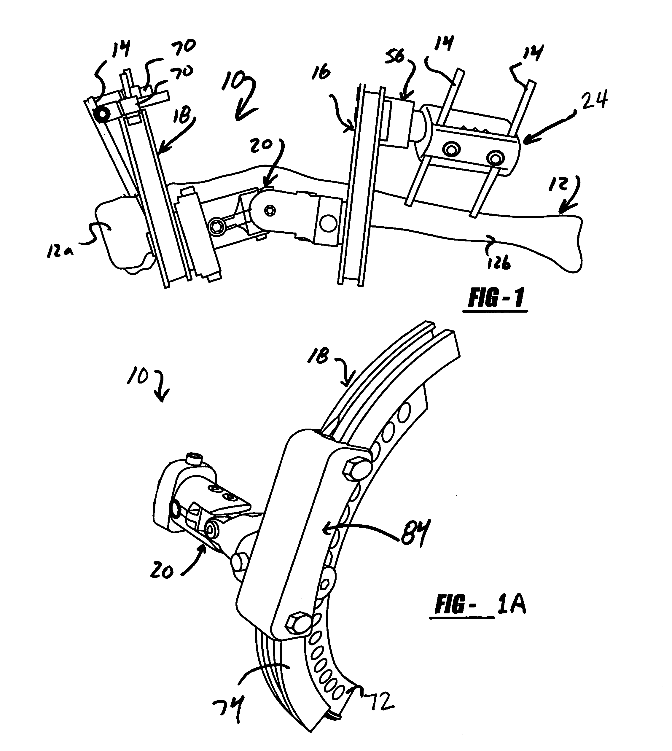 Method and apparatus for the external fixation and correction of bone