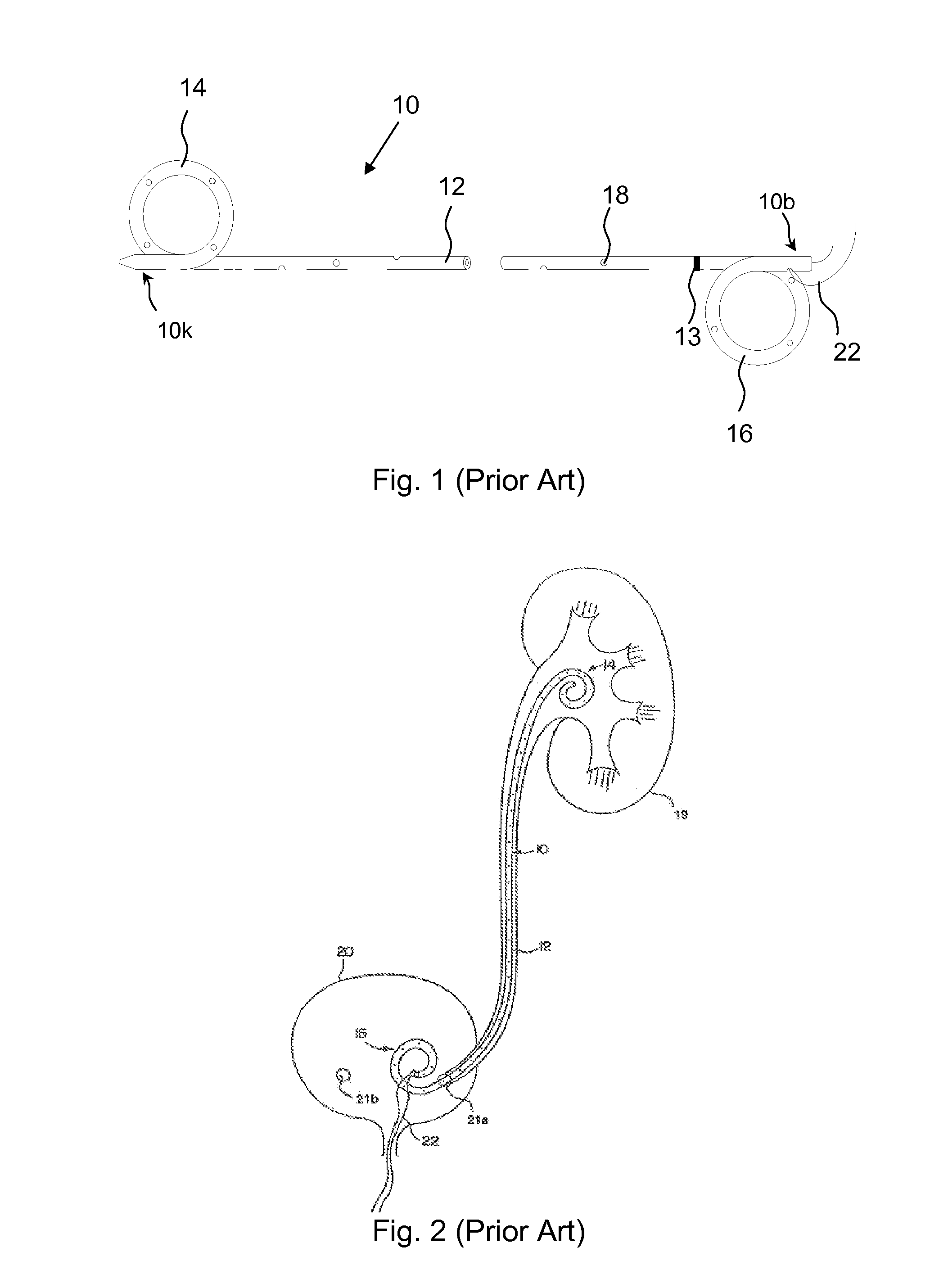 Ureteral stent with drug-releasing structure