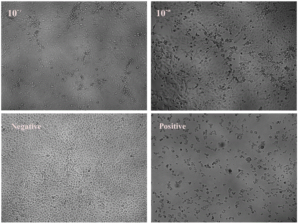 Thymosin [alpha]1-porcine interferon [alpha] fusion protein gene and preparation method of recombinant protein of fusion protein gene