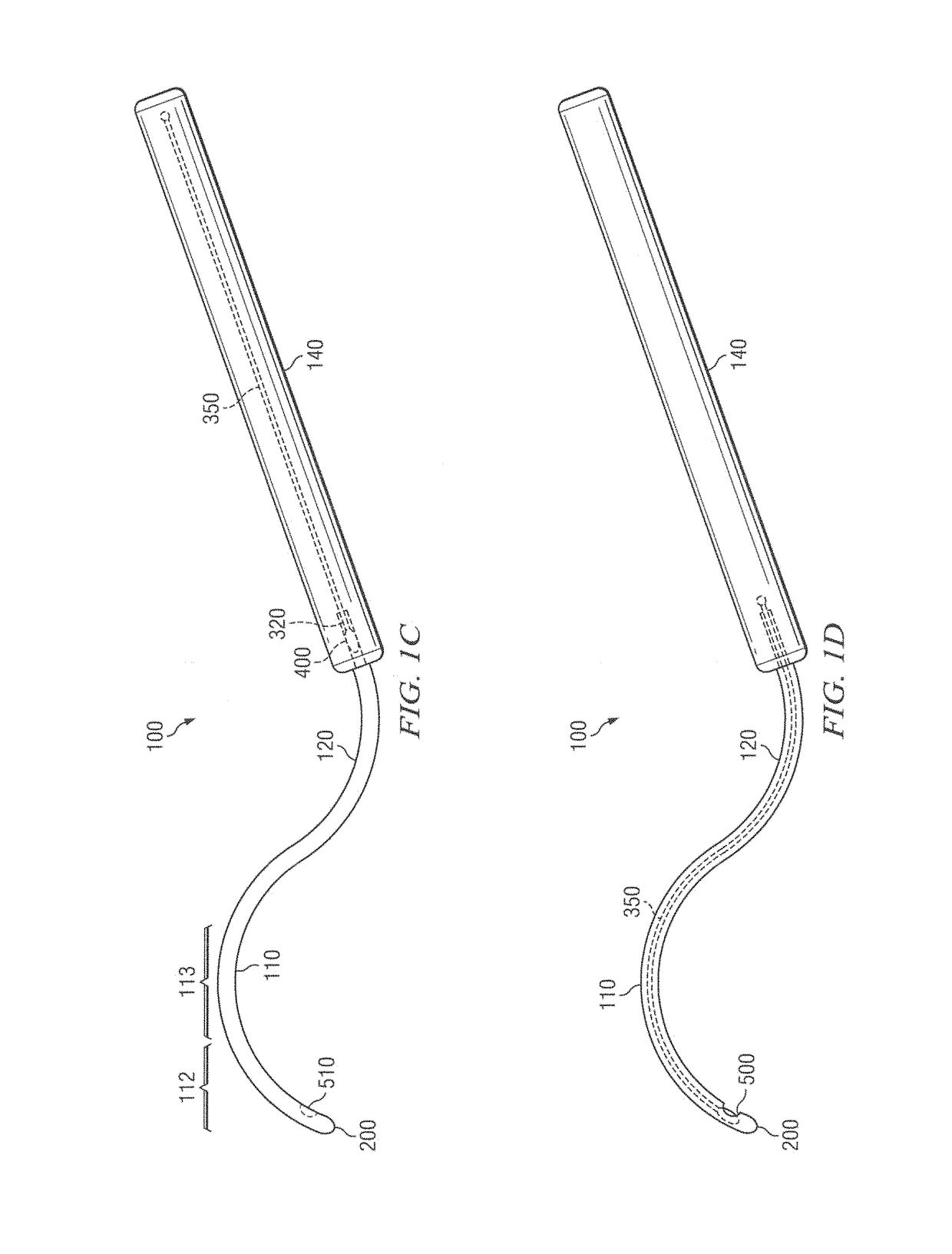 Methods and devices for minimally-invasive delivery of radiation to the eye