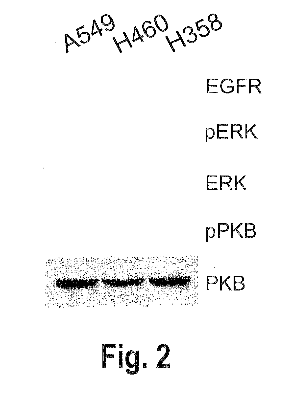 Combination of a purine-based cdk inhibitor with a tyrosine kinase inhibitor and use thereof in the treatment of proliferative disorders