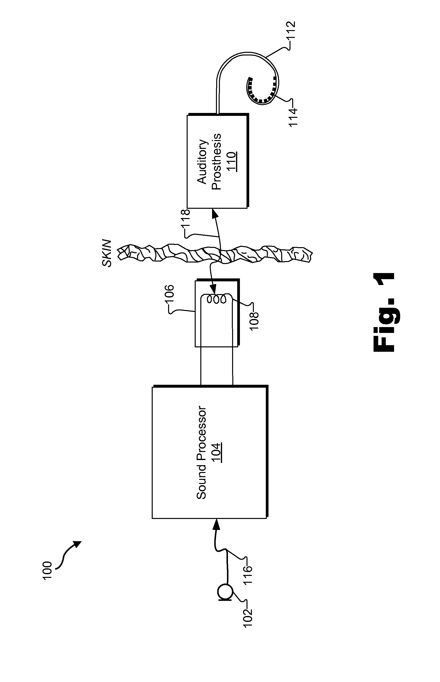 Methods and systems for facilitating adjustment of one or more fitting parameters by an auditory prosthesis patient