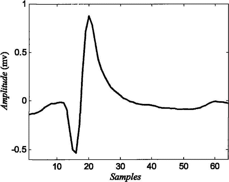 Neuron action potential feature extraction method based on singular spectrum entropy