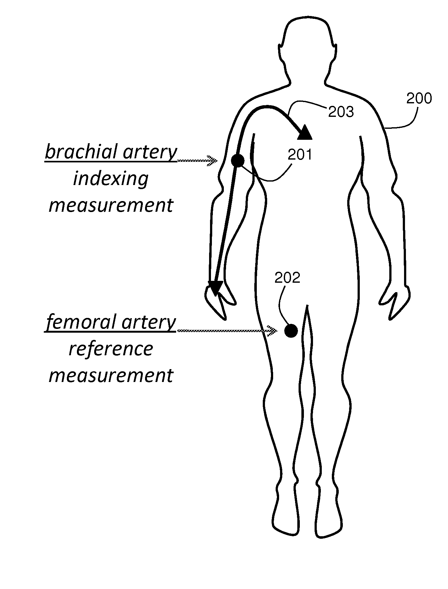 BODY-WORN SYSTEM FOR MEASURING CONTINUOUS NON-INVASIVE BLOOD PRESSURE (cNIBP)