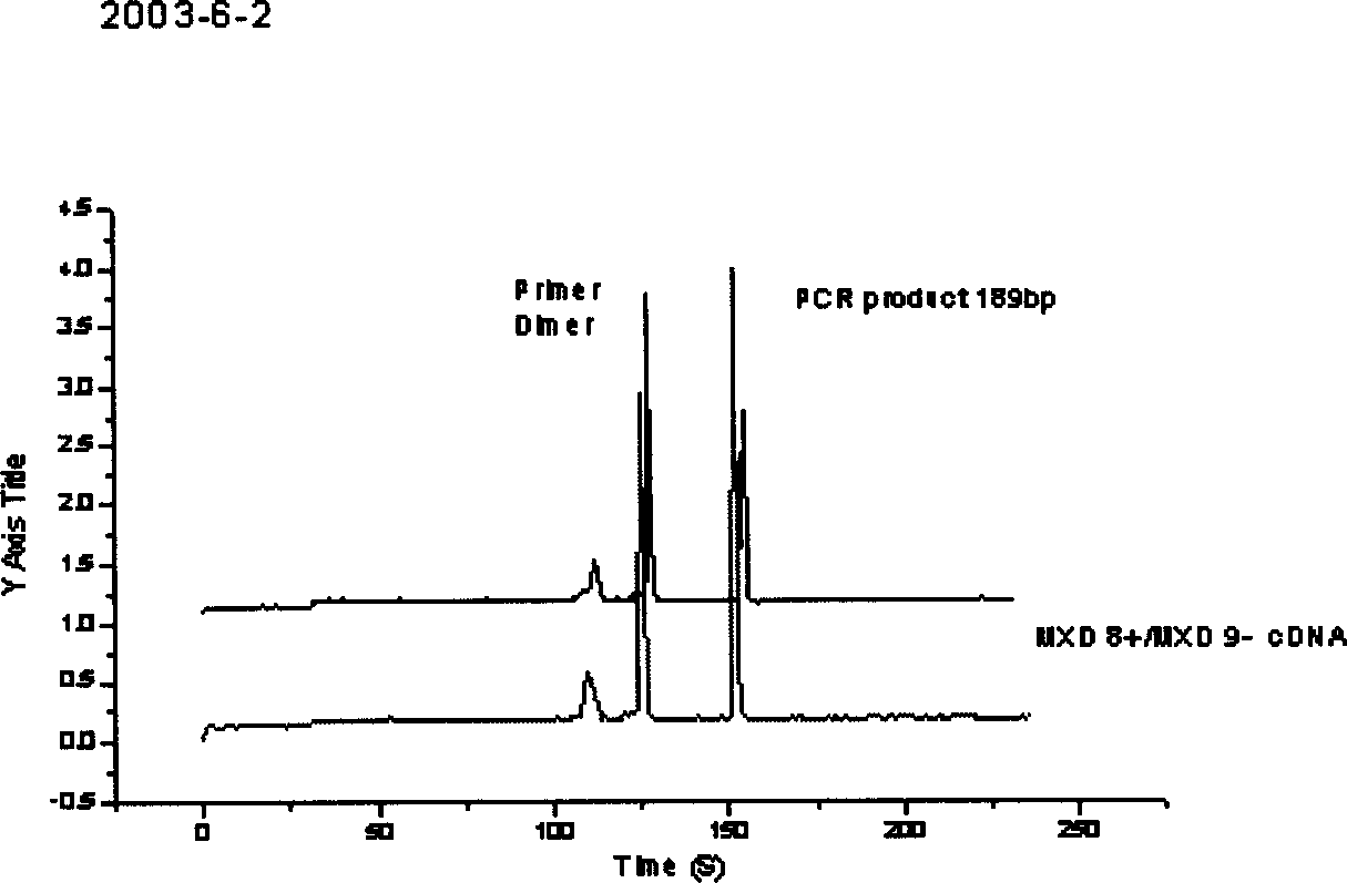 Diagnosis reagent box for detecting SARS coronavirus using transcription PCR method