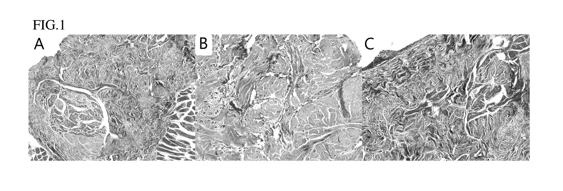 Pharmaceutical composition for preventing or treating diabetic erectile dysfunction comprising C3G or extract of mulberry containing C3G