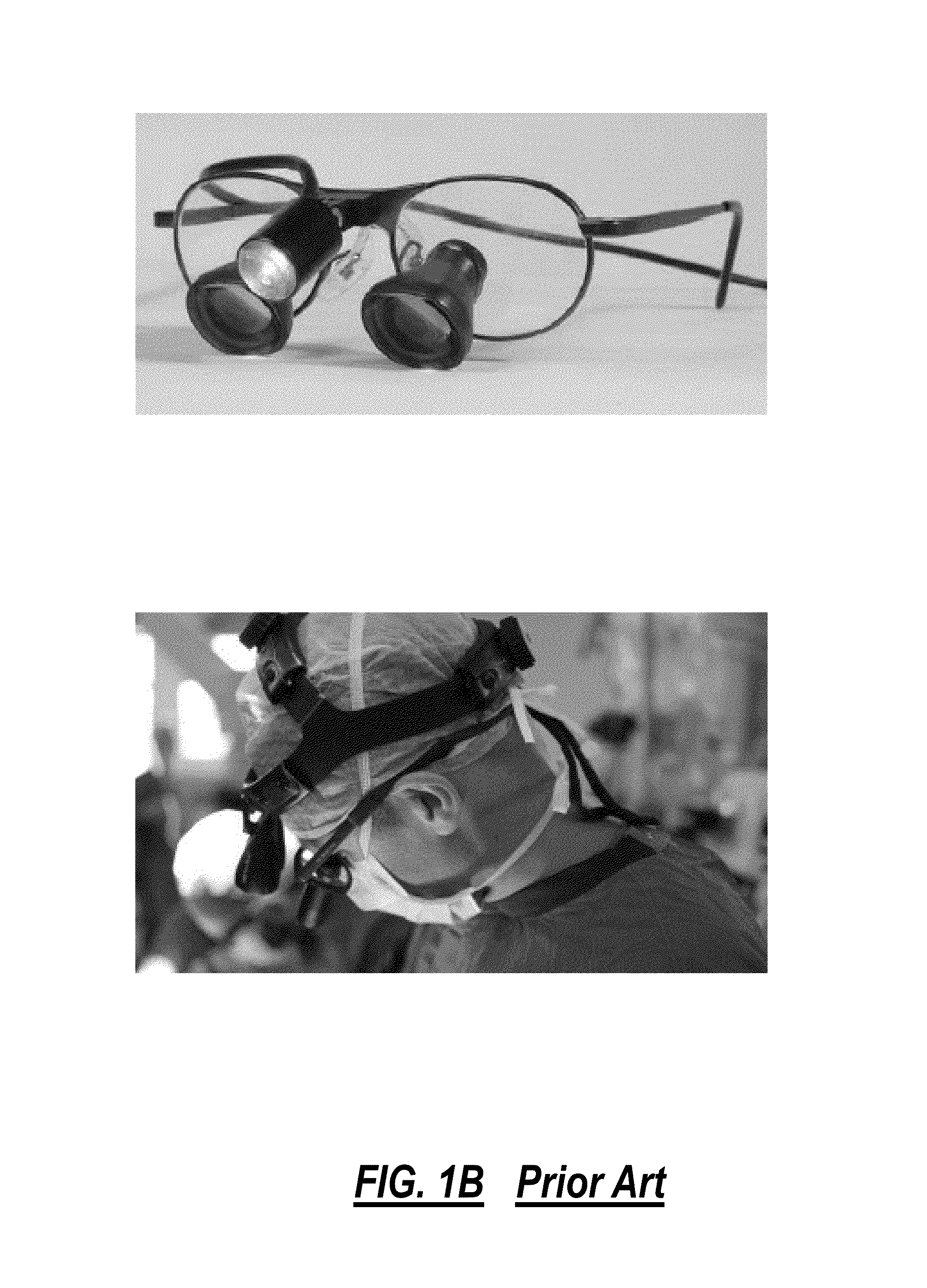 Surgical stereo vision systems and methods for microsurgery