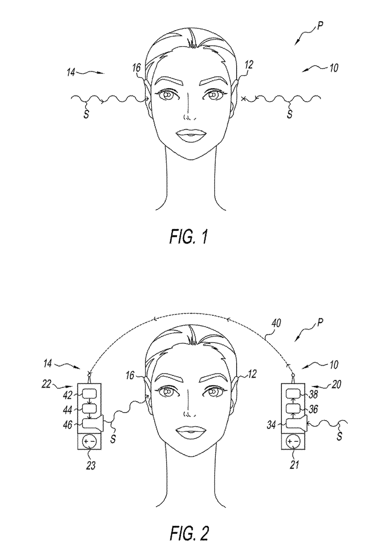 Hearing aid for people having asymmetric hearing loss