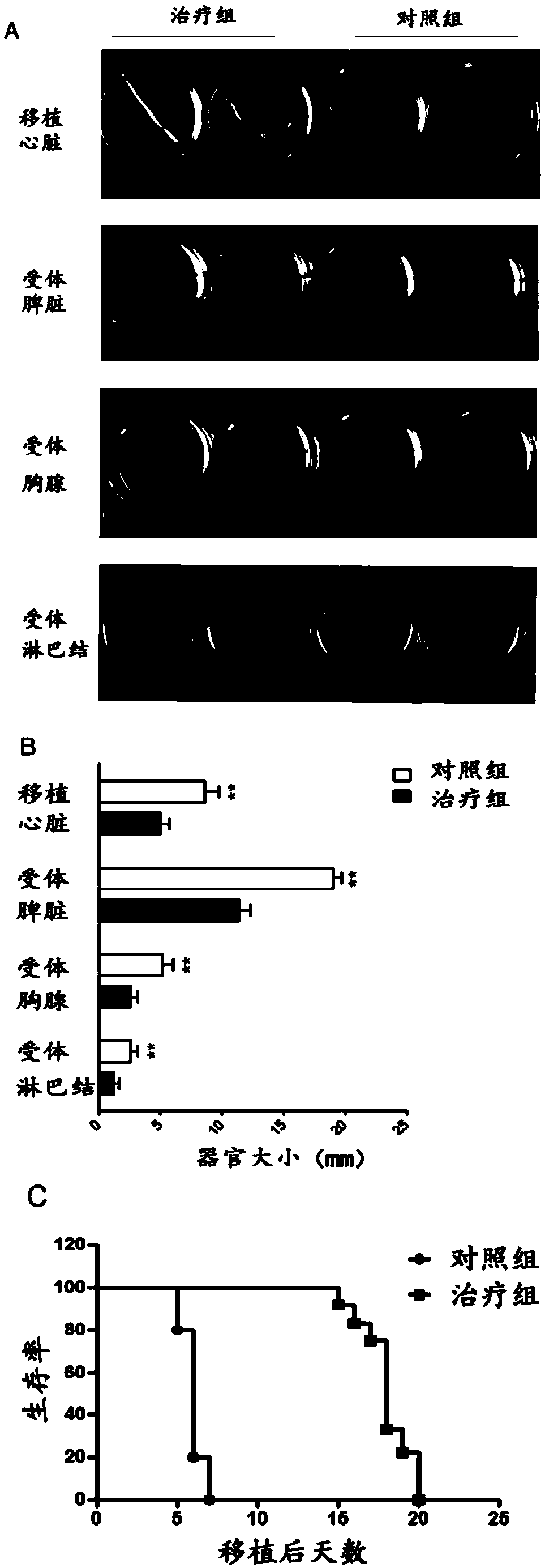 Application of mir-29 and its inhibitors in the preparation of anti-organ transplantation rejection drugs