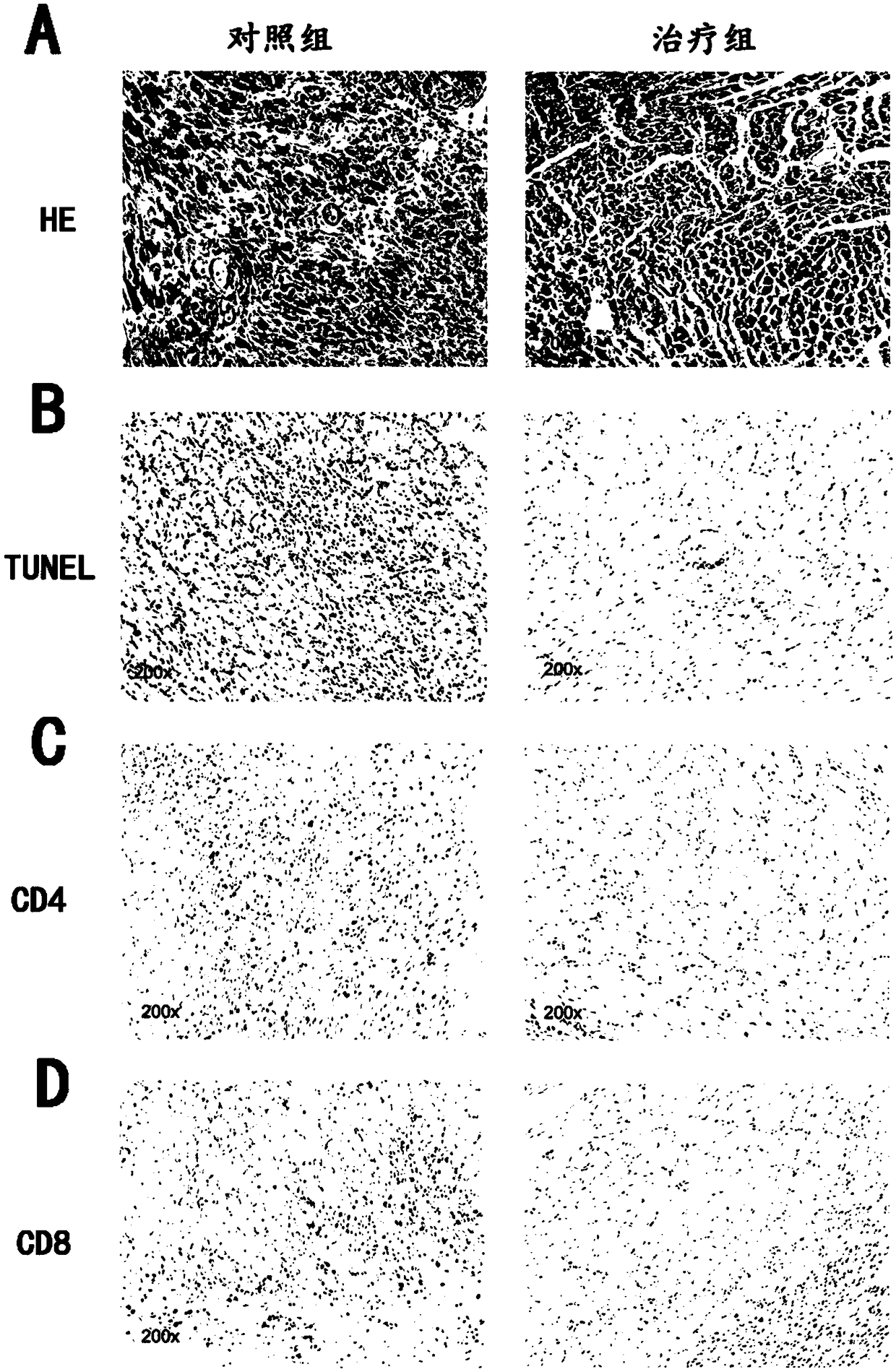 Application of mir-29 and its inhibitors in the preparation of anti-organ transplantation rejection drugs