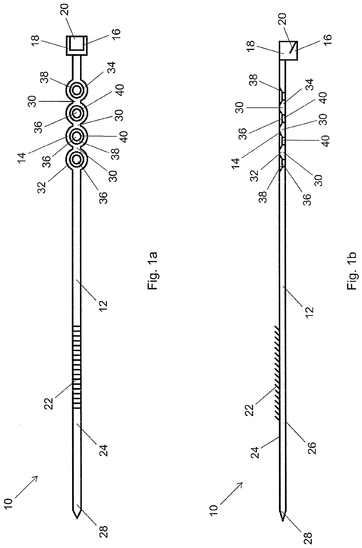 Fixation Assembly With A Flexible Elongated Member For Securing Parts of a Sternum