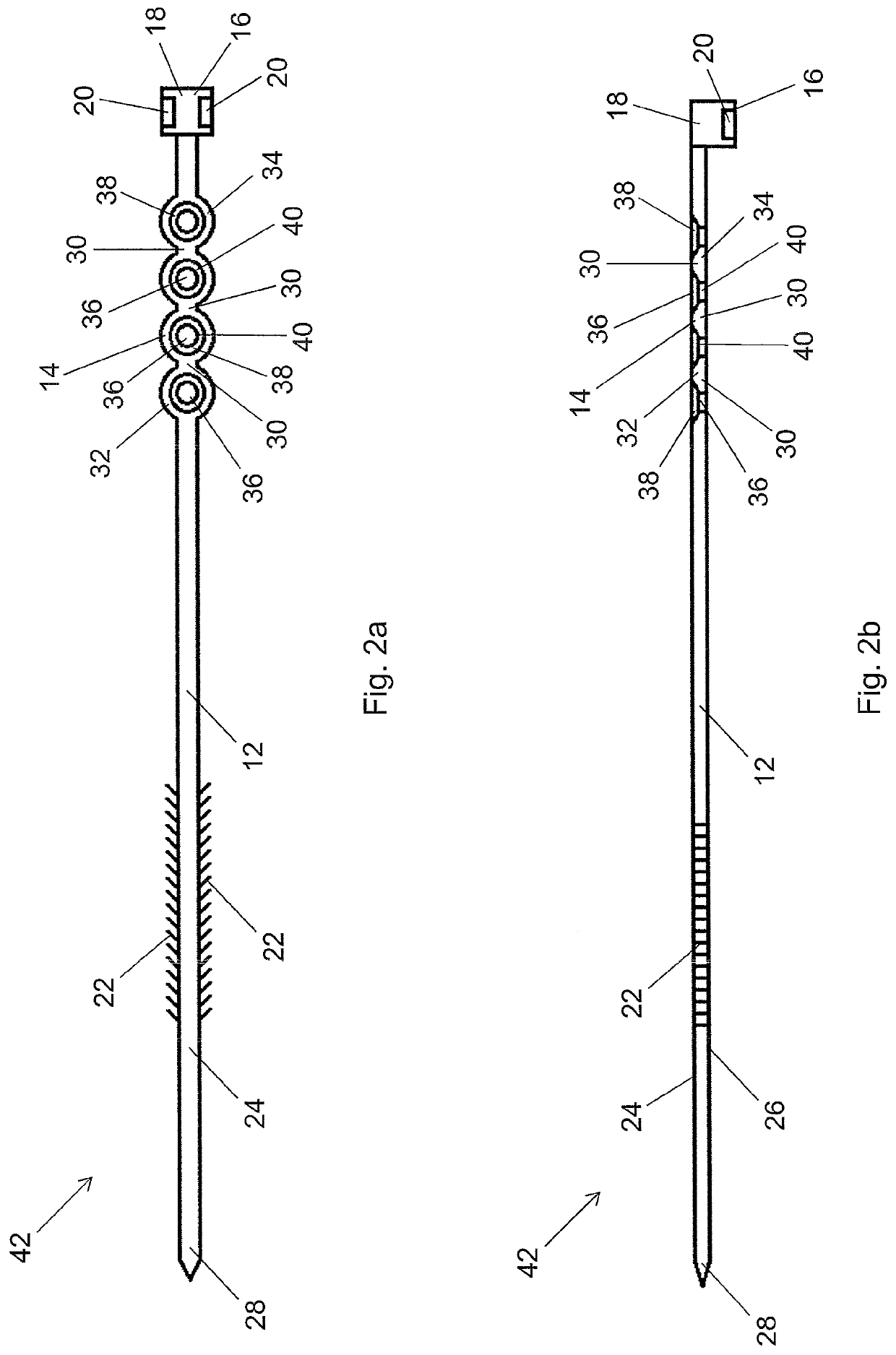 Fixation Assembly With A Flexible Elongated Member For Securing Parts of a Sternum