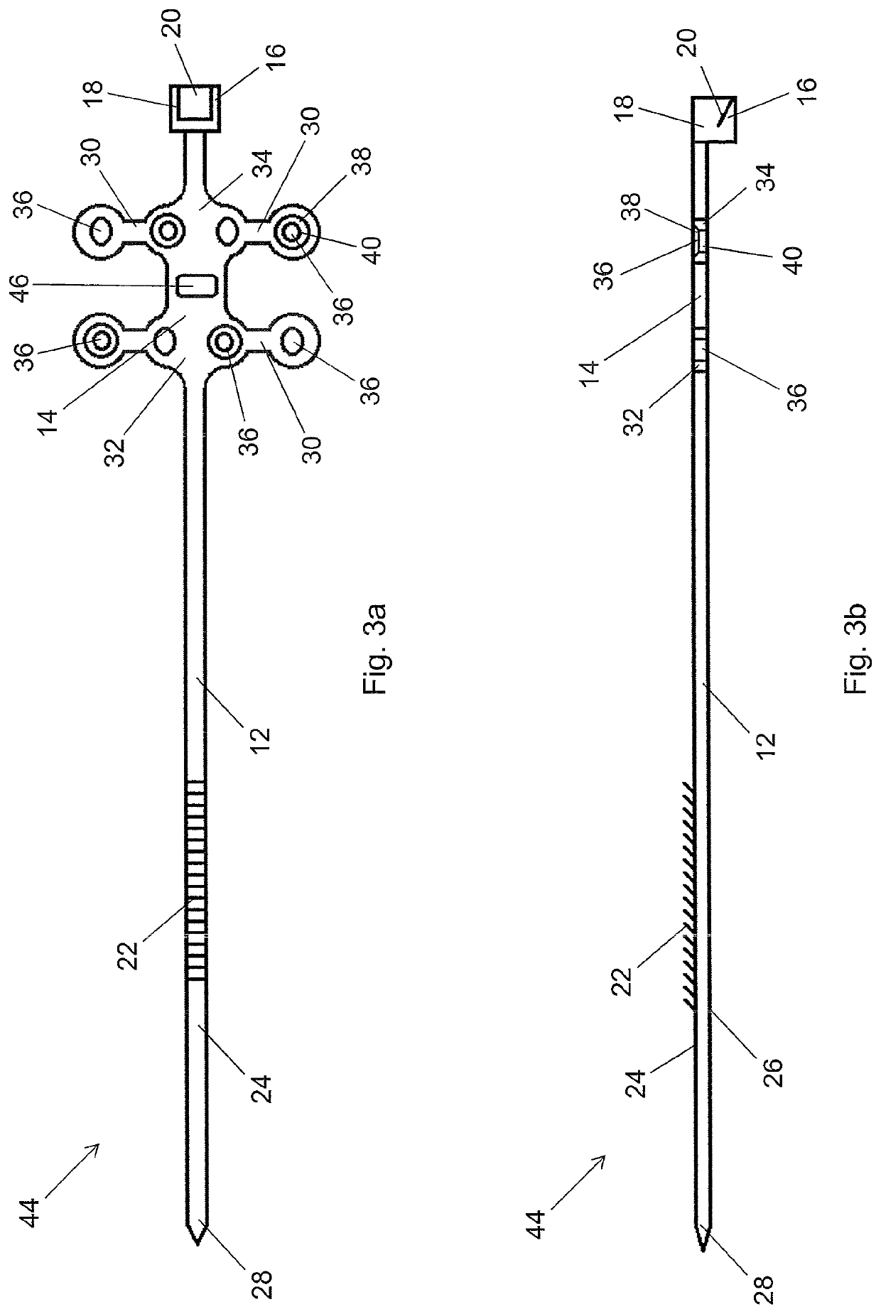 Fixation Assembly With A Flexible Elongated Member For Securing Parts of a Sternum