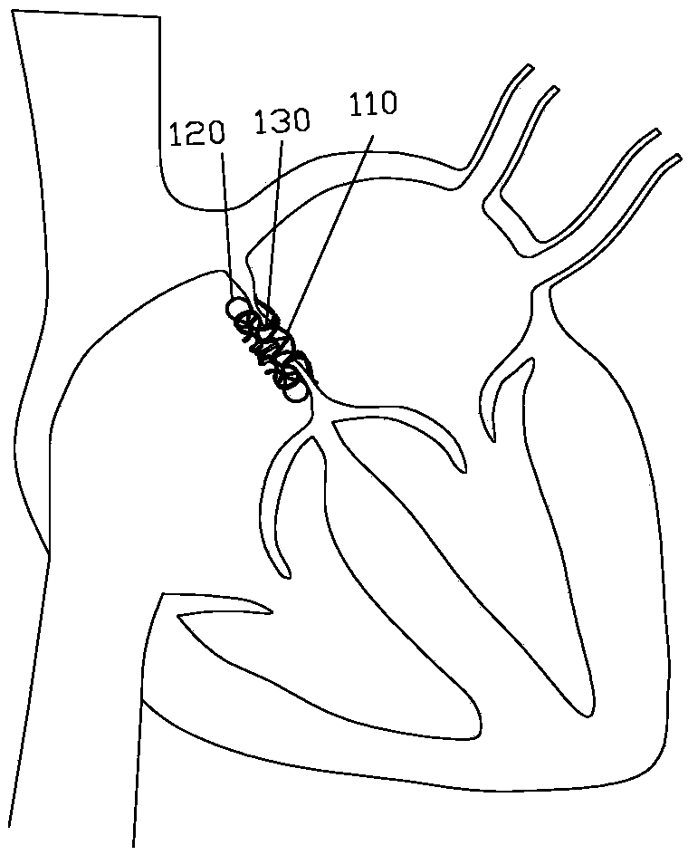 Pressure Regulator in Heart chamber