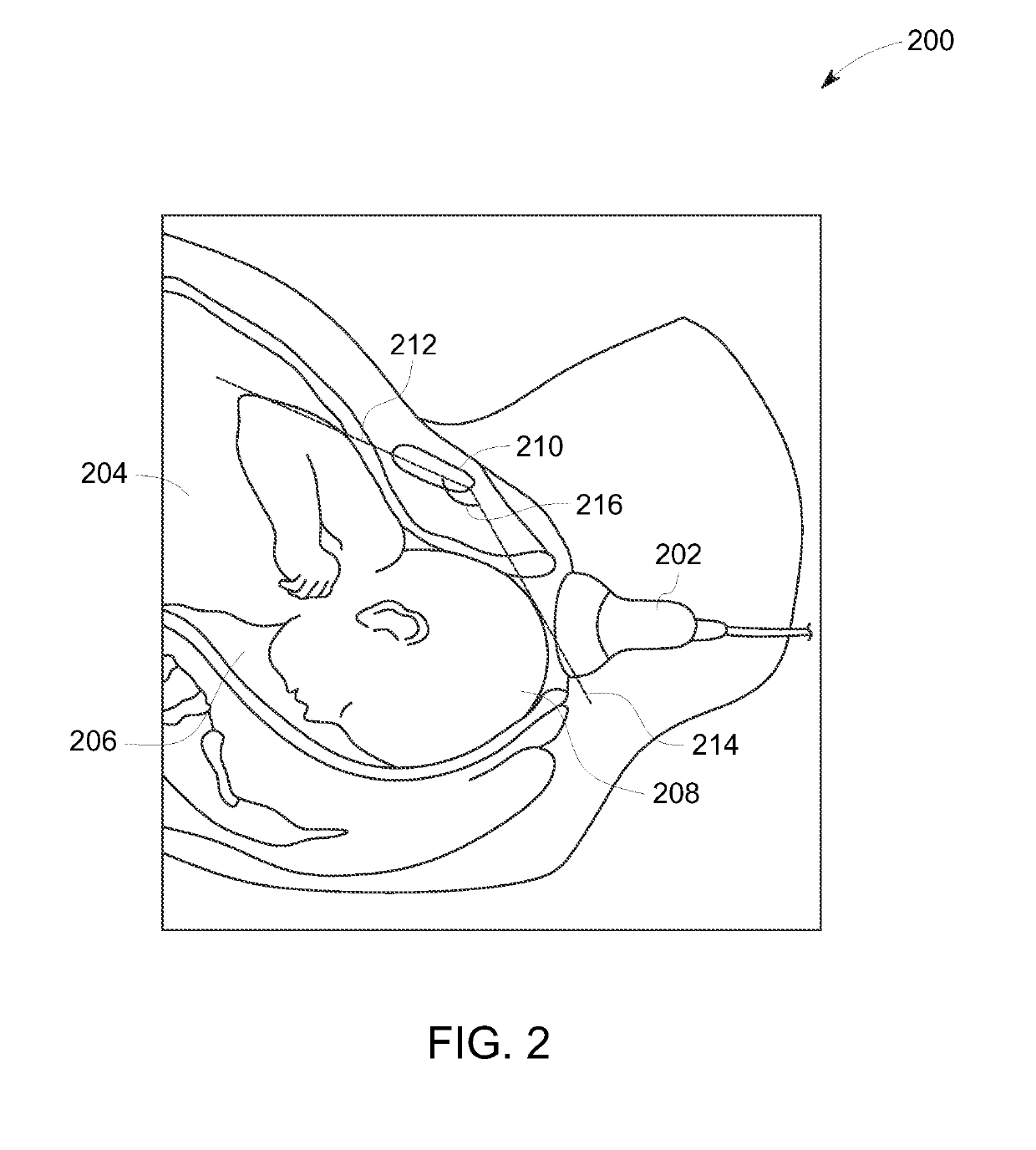 System and method for automated monitoring of fetal head descent during labor