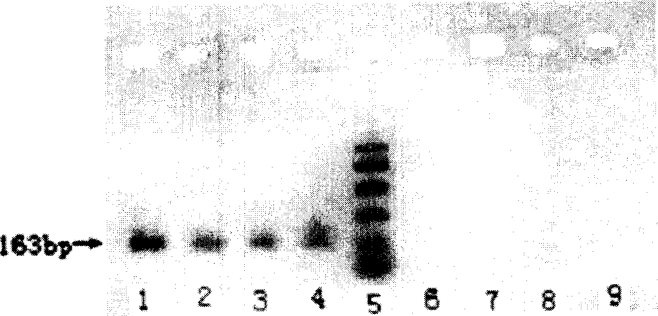 PCR amplification primer, kit and use thereof in identification of mammal sex