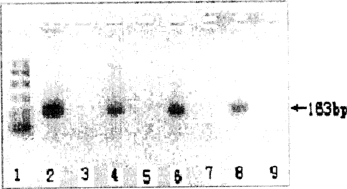 PCR amplification primer, kit and use thereof in identification of mammal sex