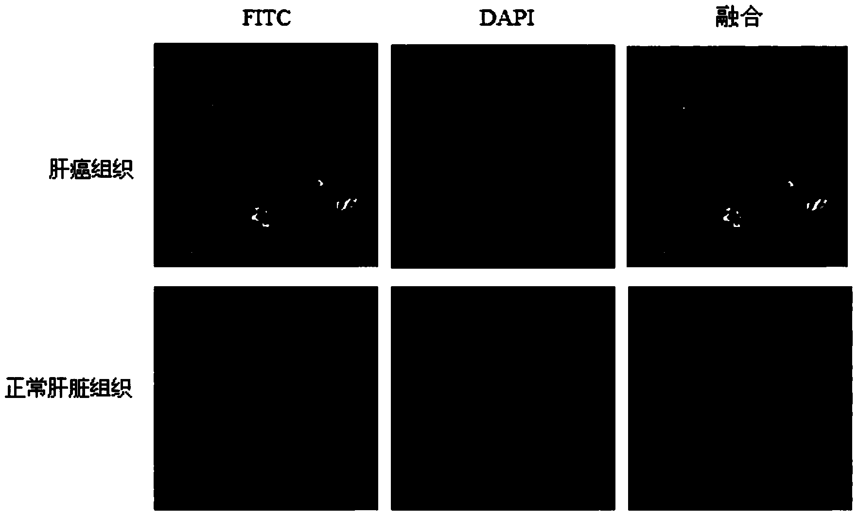 Anti-hepatoma stem cell monoclonal antibody and application thereof