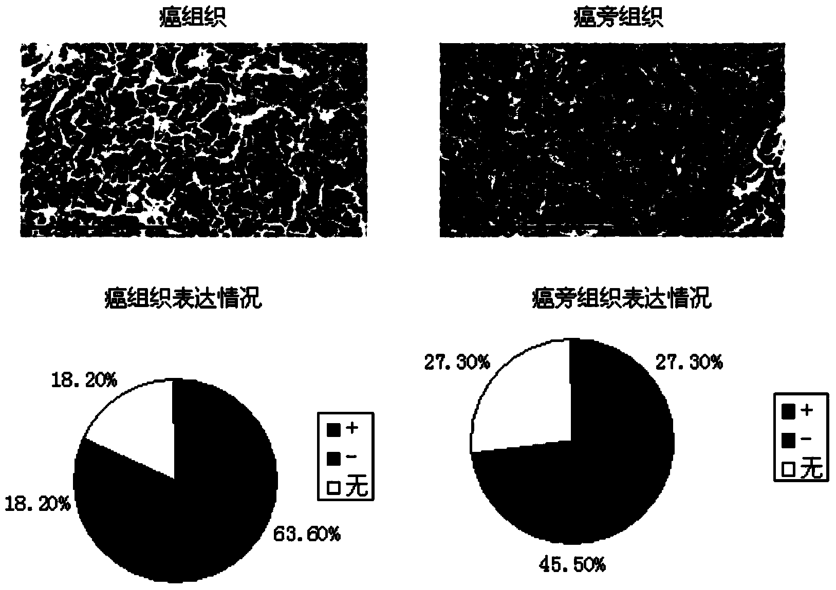 Anti-hepatoma stem cell monoclonal antibody and application thereof