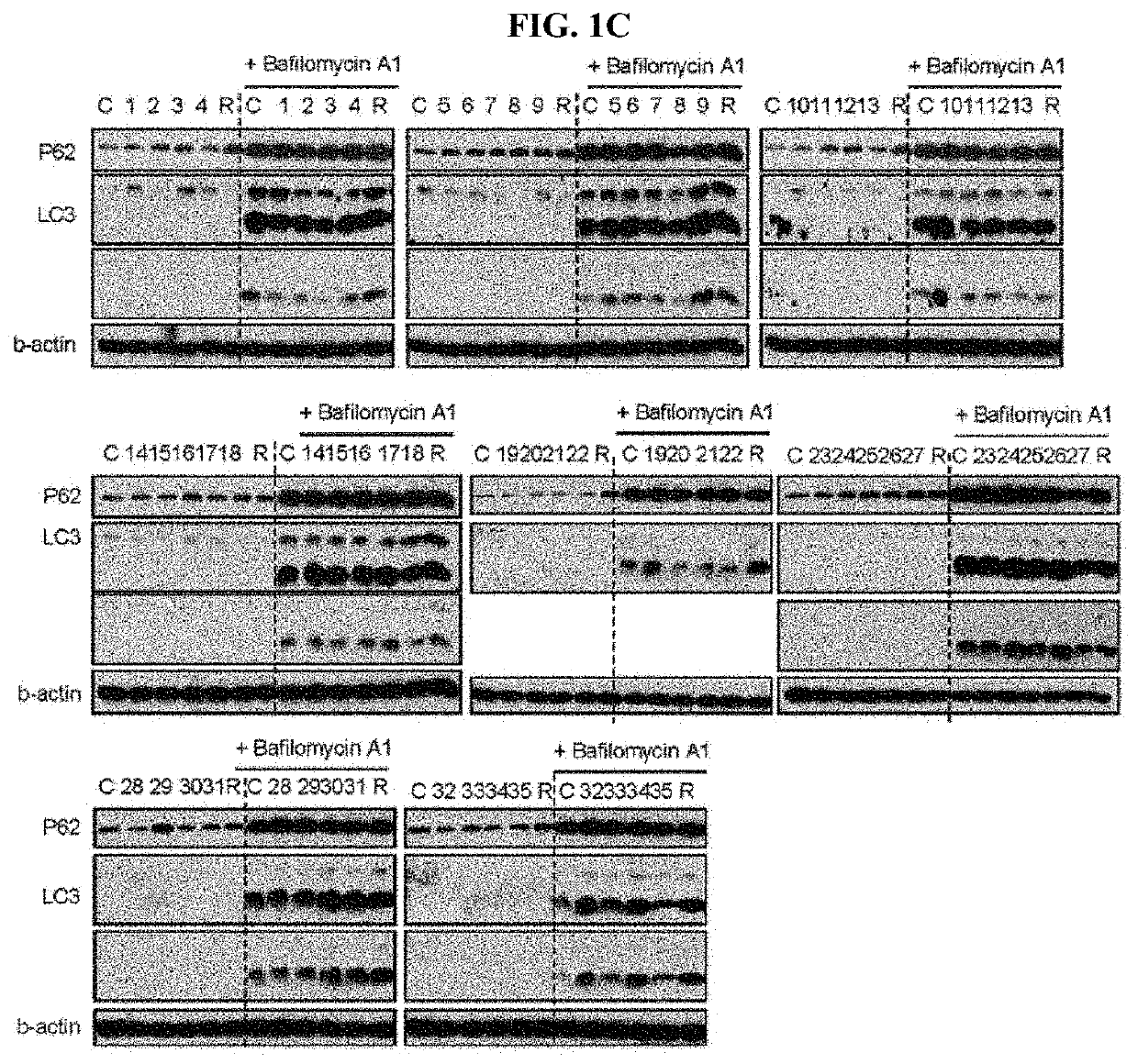 Autophagy enhancer and use thereof