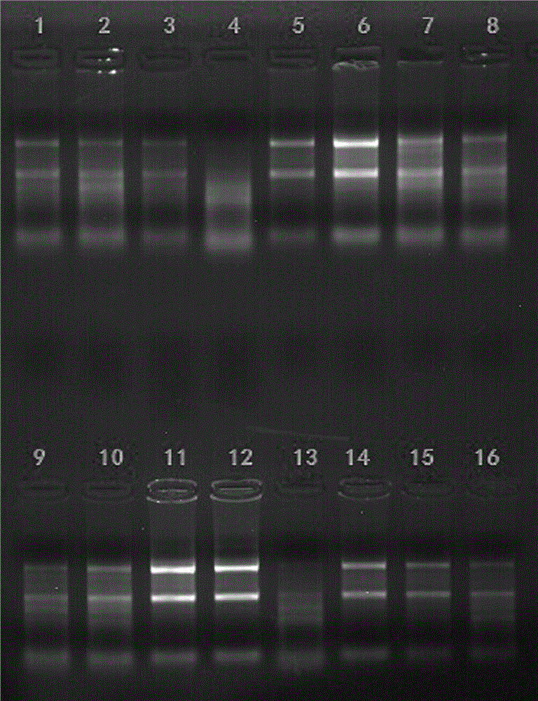 RT-PCR primers for detecting transcriptional level of NOX1 mRNA in serum as well as kit and method for evaluating concurrent intestinal cancer susceptibility of hyperglycemia population