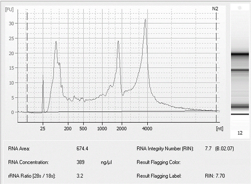 RT-PCR primers for detecting transcriptional level of NOX1 mRNA in serum as well as kit and method for evaluating concurrent intestinal cancer susceptibility of hyperglycemia population