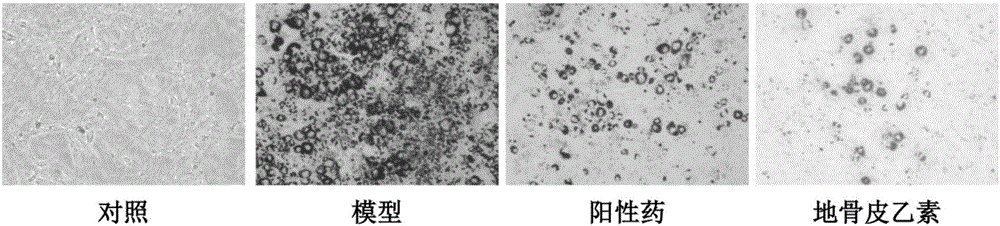 Application of kukoamine in preparing medicine for treating type II diabetes mellitus