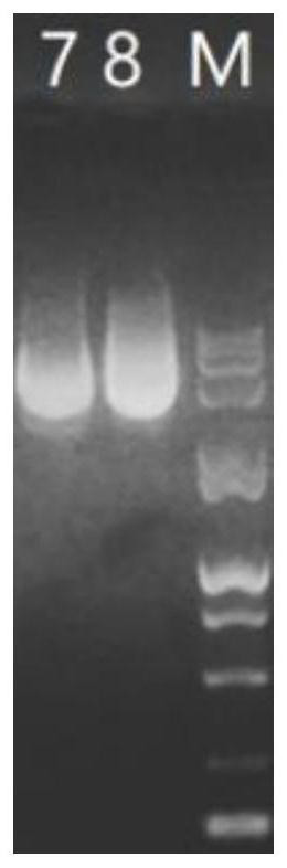 A wnt4/ywhaz co-modified mesenchymal stem cell-derived exosome and its preparation method and application