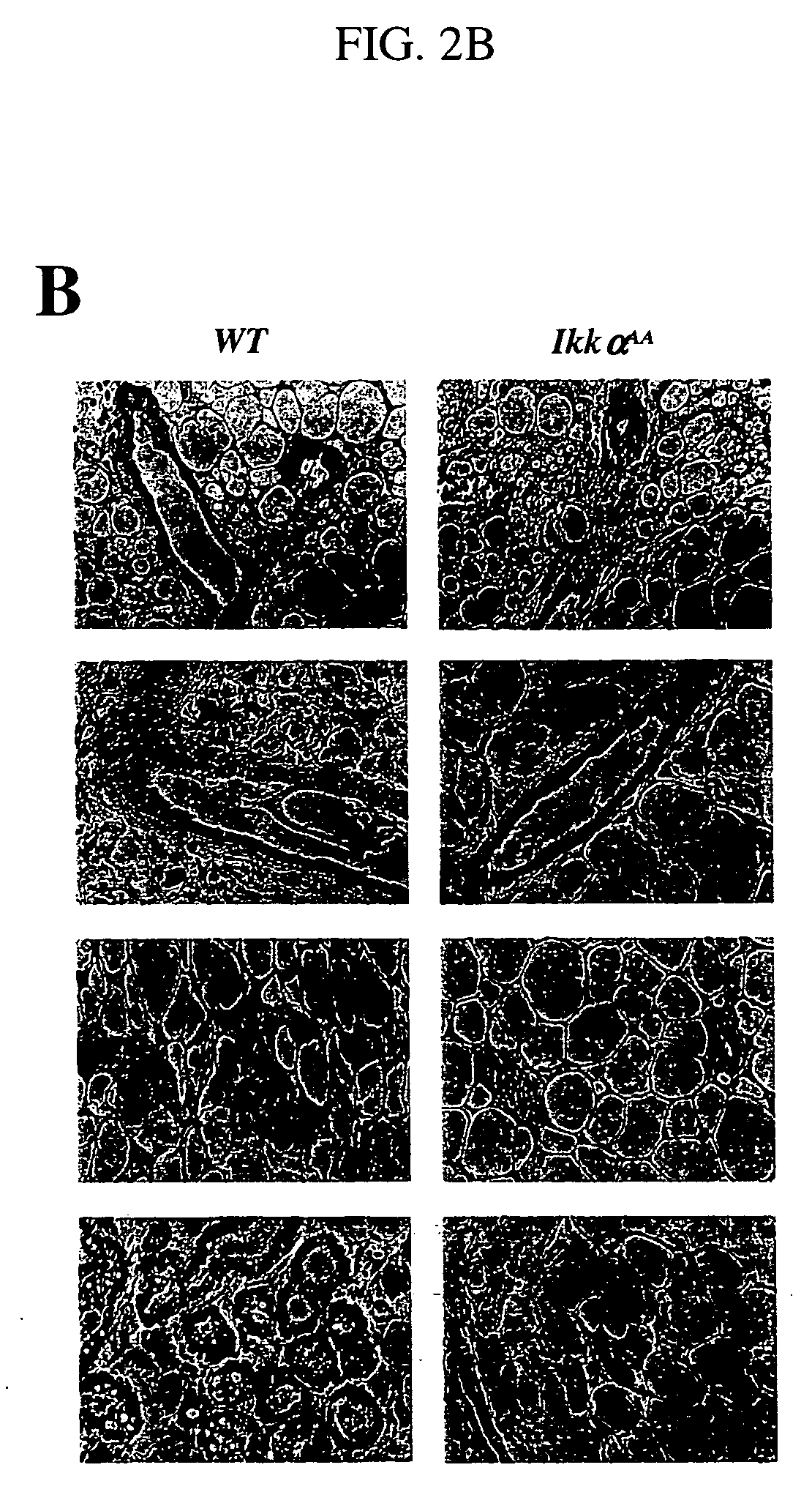 Compositions and methods for the suppression of mammary epithelial cell proliferation