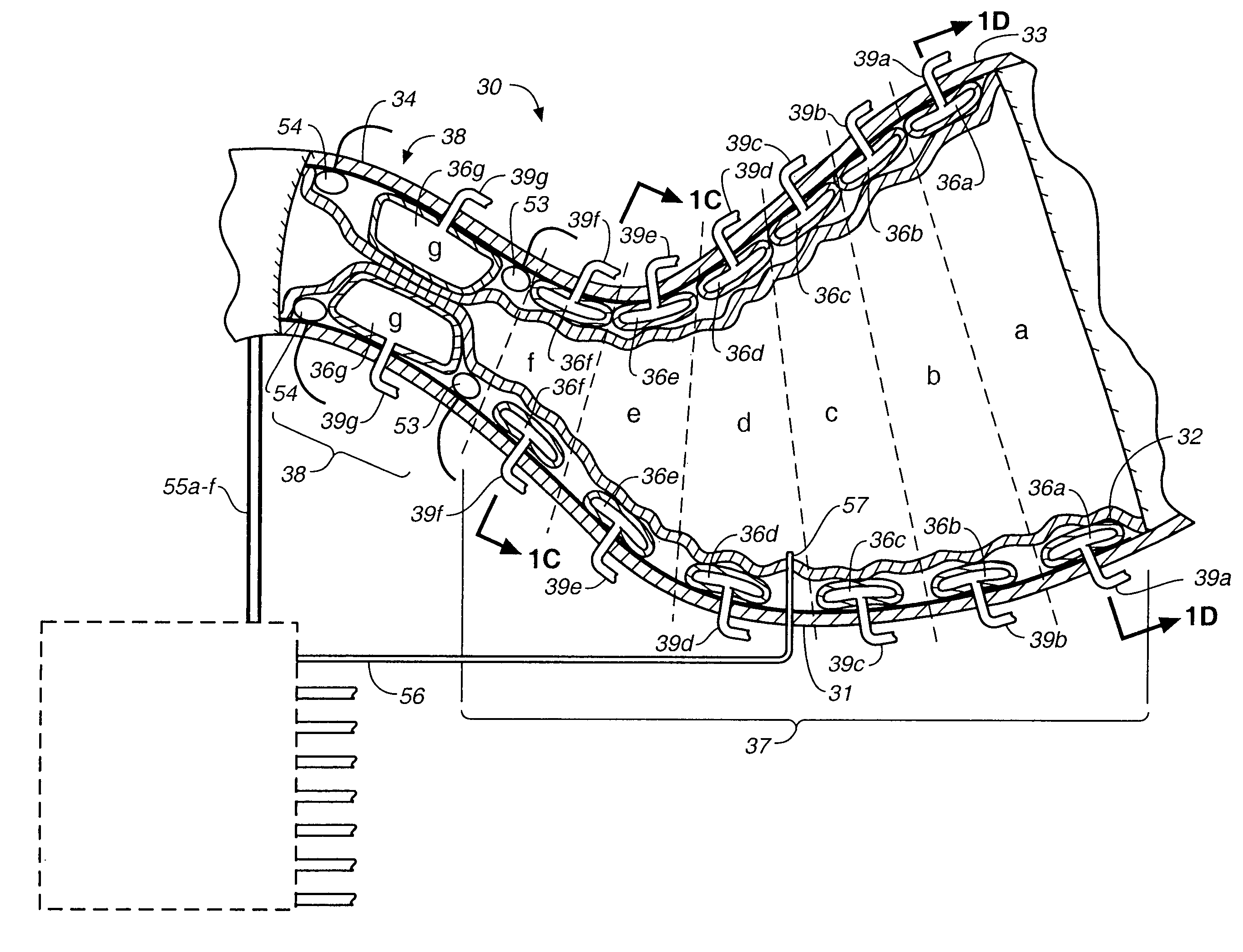 Stomach peristalsis device and method