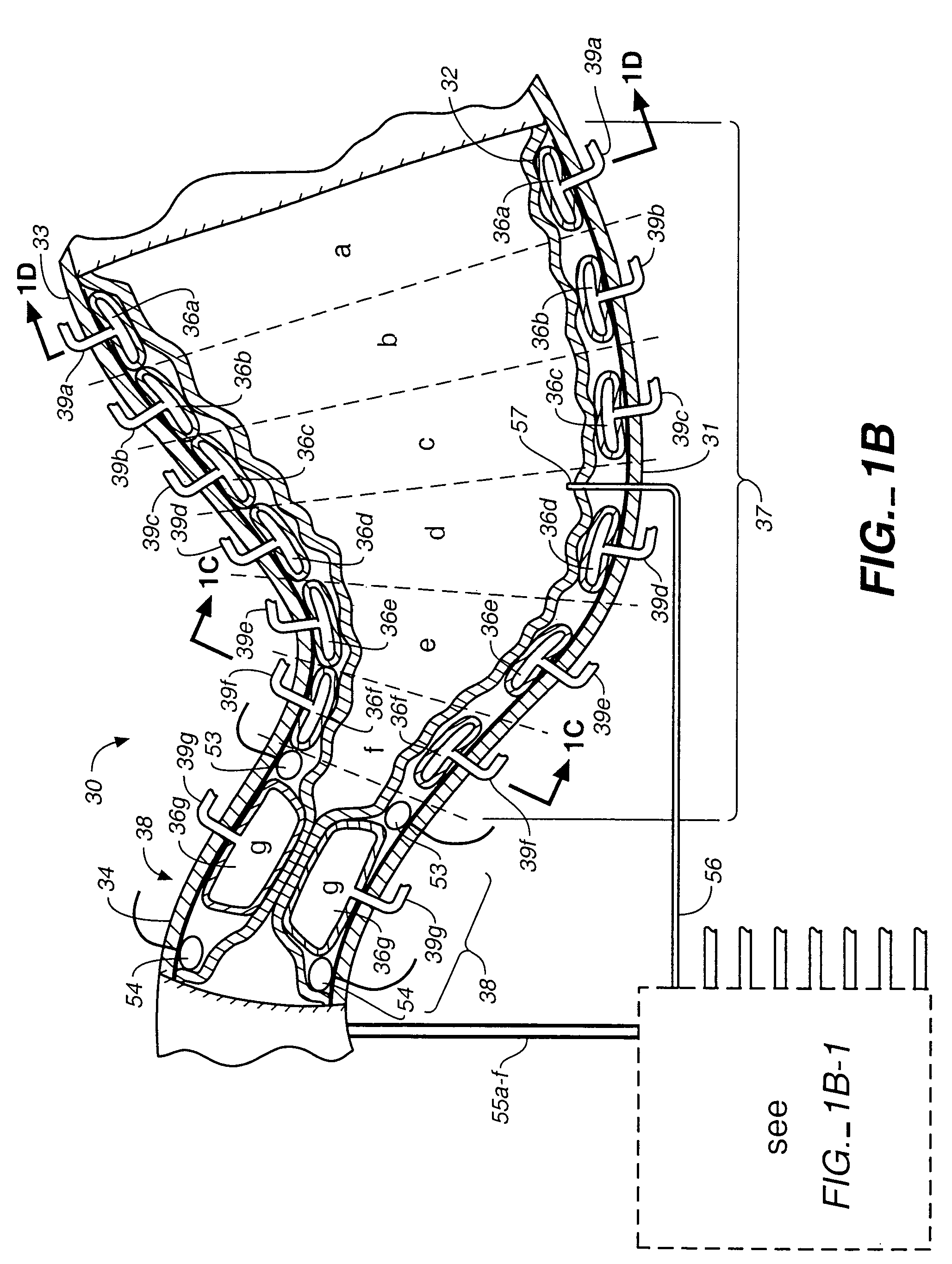 Stomach peristalsis device and method