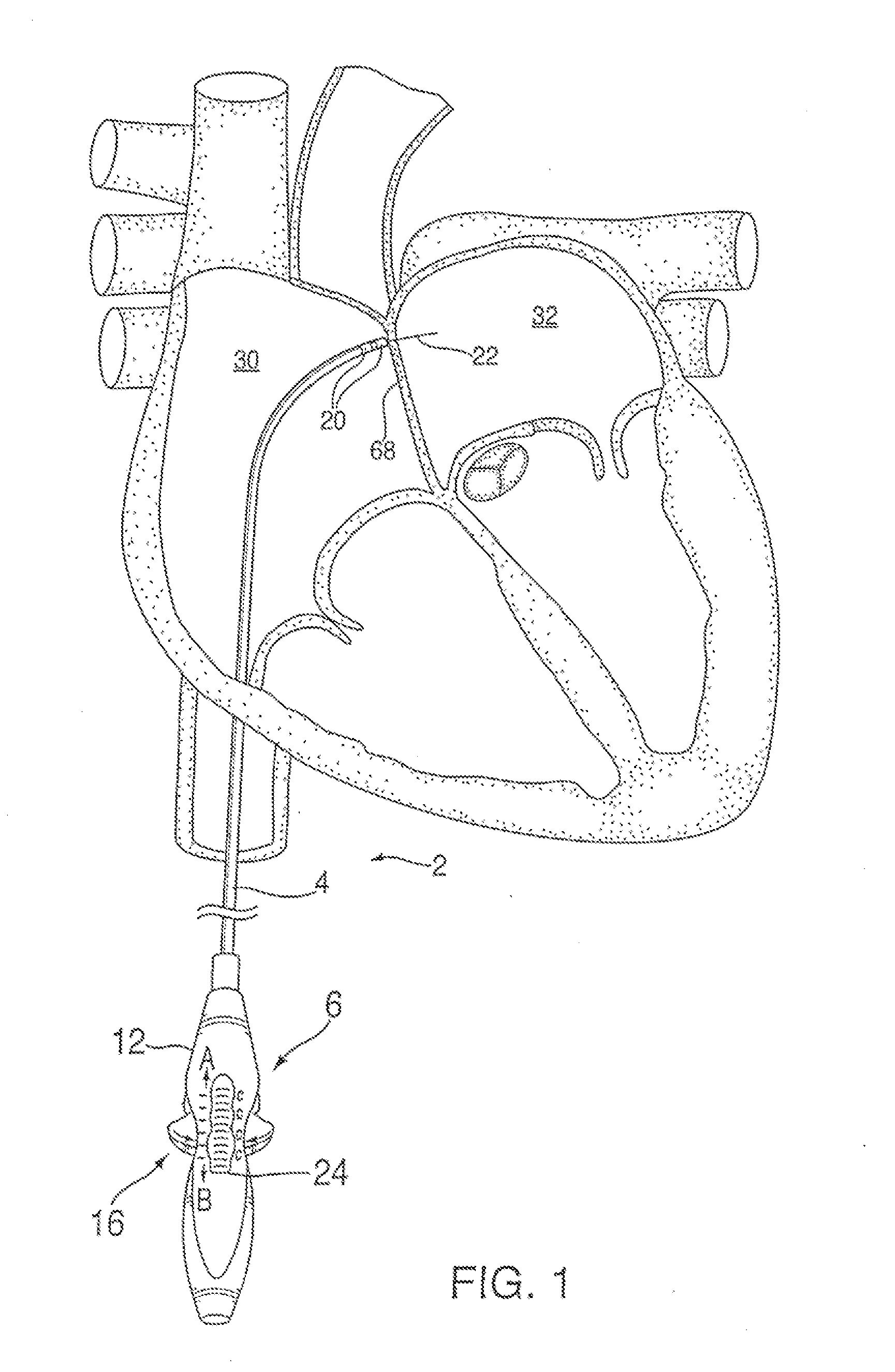 Apparatus for safe performance of transseptal technique and placement and positioning of an ablation catheter