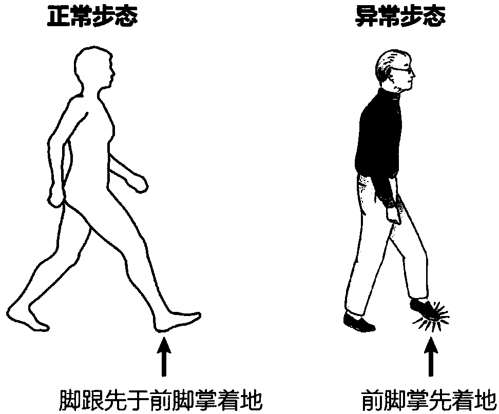 Parkinson patient abnormal motion prompting method and device